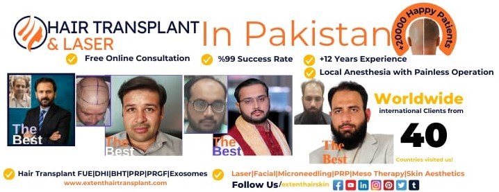 1 Extent Hair Transplant